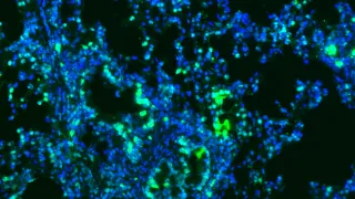 Syöpävaaralliseksi luokitellulla Mitsui-7 hiilinanoputkimateriaalilla altistetun hiiren keuhkokudosleike, jossa näkyy gamma-H2AX-menetelmällä vihreäksi leimattuja DNA:n kaksoisjuostekatkoksia DAPI-värjätyissä sinisissä tumissa.
